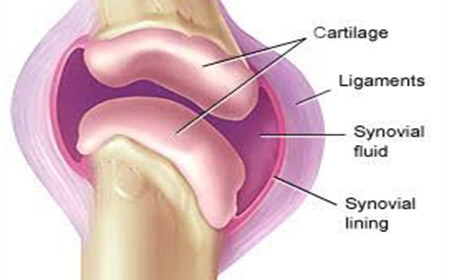 Arthritis management in nashik | Dr. Shreyans Shah