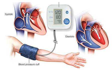 Hypertension Treatment in Nashik | Dr. Shreyans Shah
